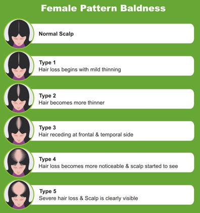 Female Pattern Baldness | Dr Aditis Advanced Homeopathy