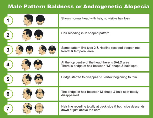 androgenetic-alopecia